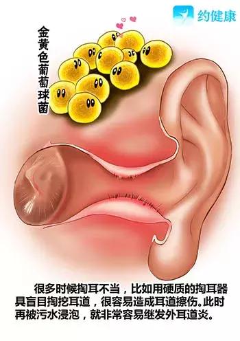 游泳耳朵进水了一直嗡嗡响怎么弄,游泳时耳朵进水了有点疼怎么处理