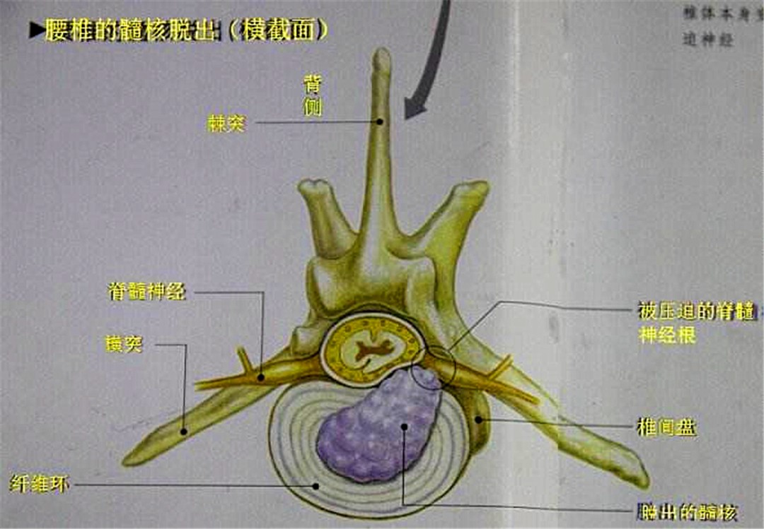 辟谣，狗狗也会腰椎盘突出，不合理运动伤害大，关注三点正确护理