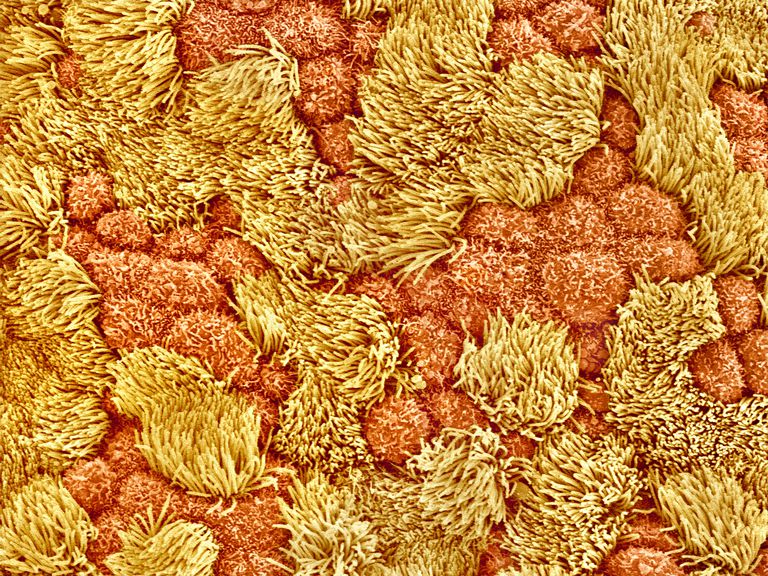 一般人绝对想不到,身体上的毛有哪几种