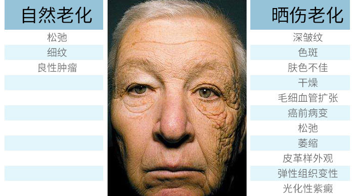 晒伤皮肤修护推荐,适合晒伤修复的护肤品