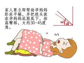 突然漏尿湿一片是怎么回事,早上湿了一小片是漏尿还是破水