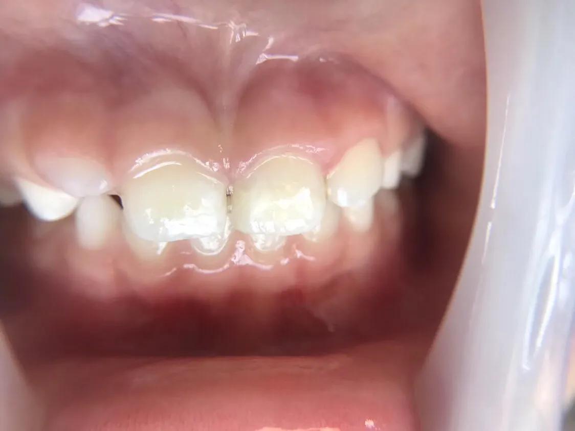 口腔护理中的垃圾怎么分类处理,口腔医疗垃圾和生活垃圾分类