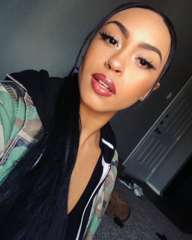 舞娘失手从6米高钢管摔到地面！下巴被摔碎！发众筹请求帮助