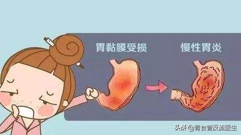 兰索拉唑和枸橼酸莫沙必利,兰索拉唑与莫沙必利的作用与功效