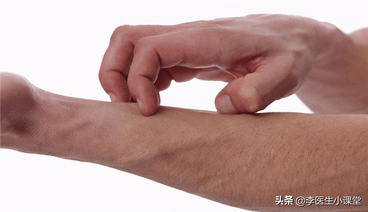肛门周围总是潮湿瘙痒，是什么疾病？医生告诉你应该怎么治疗？