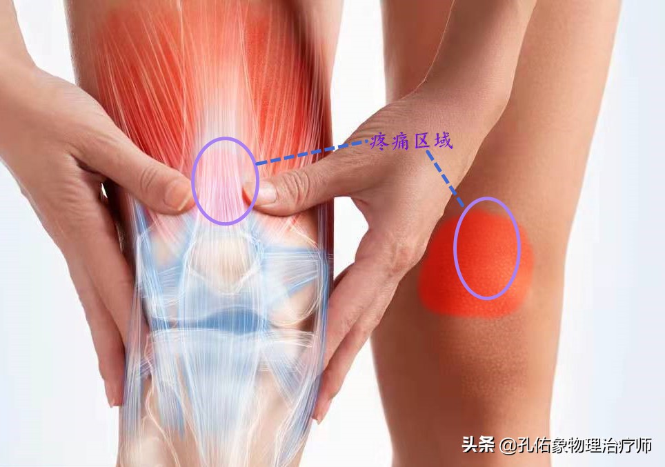 膝关节疼痛位置判断得了什么病,膝关节疼痛一般什么原因引起的