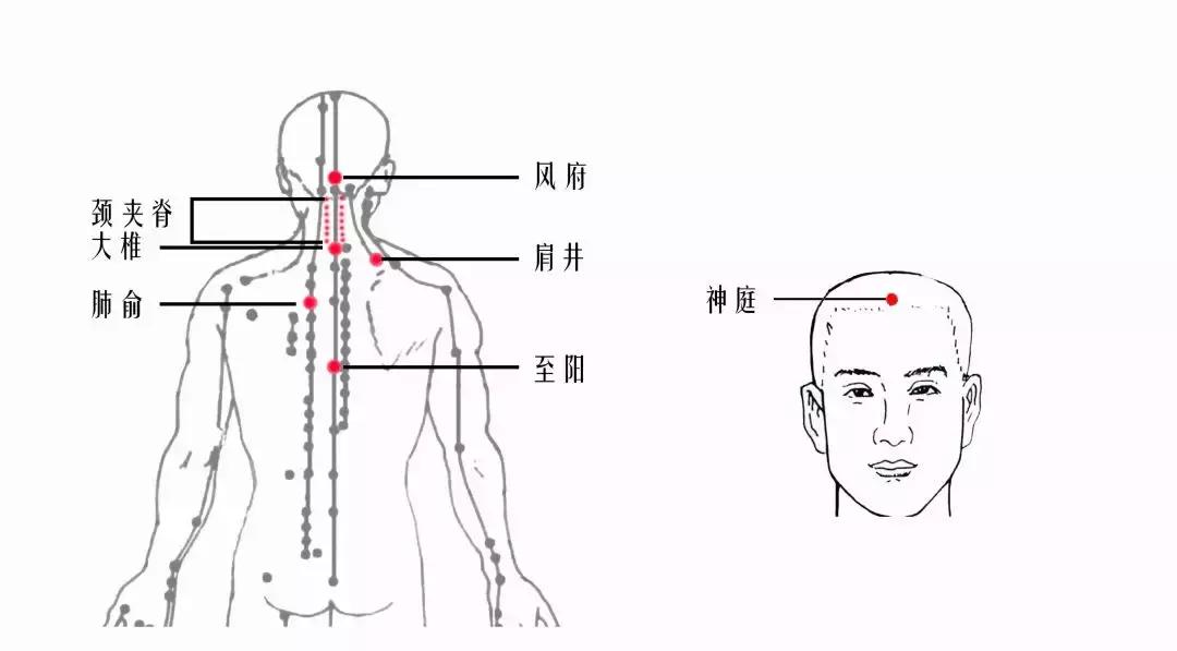 颈椎腰腿痛针刀,针刀颈椎病