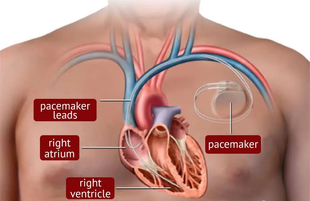 心脏供血不够心跳慢吃什么药,心跳慢心脏不舒服