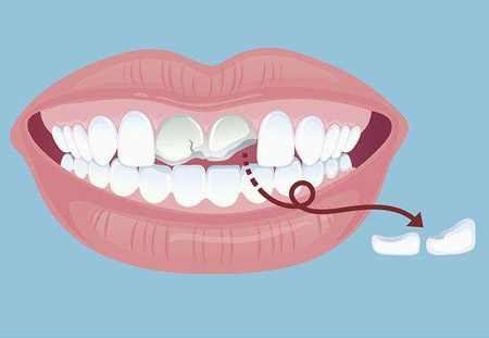 龇牙咧嘴的咧的读音,龇牙咧嘴的龇的读音
