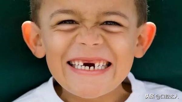 6岁的女孩换牙期关注事项,孩子要换牙了应该关注什么