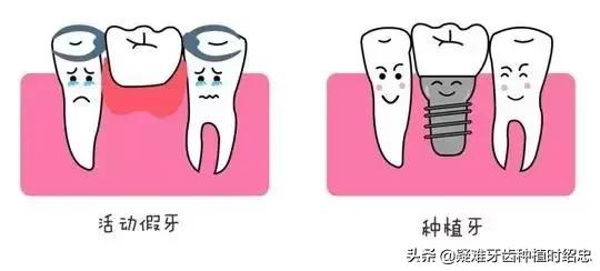 缺牙、补牙，这5大坑你掉进去了吗？