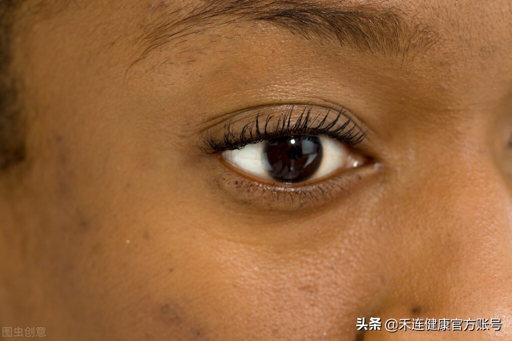 肝癌病人皮肤发黑是什么原因,脸色发黑警惕癌症