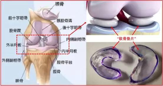 半月板损伤的症状及治疗方法图片,什么样的动作会让半月板损伤加重