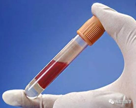 医学检验生化全套图解,常见生化检验项目及正常值