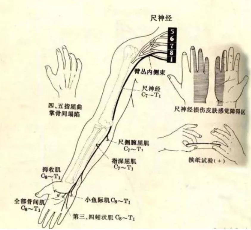 不小心磕到手了肿了,不小心磕到胳膊怎么办