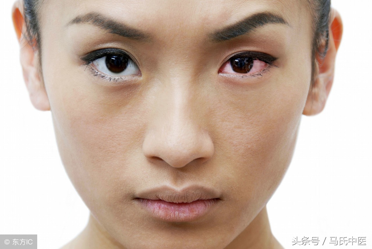 头突然红肿是什么原因,头面浮肿中医辨证治疗