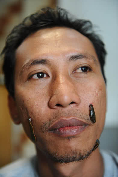 小时候田里的蚂蟥简直是噩梦,小时候最怕的蚂蝗