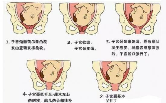胎儿入盆和没入盆的图片对比,胎儿头入盆和臀入盆有什么区别