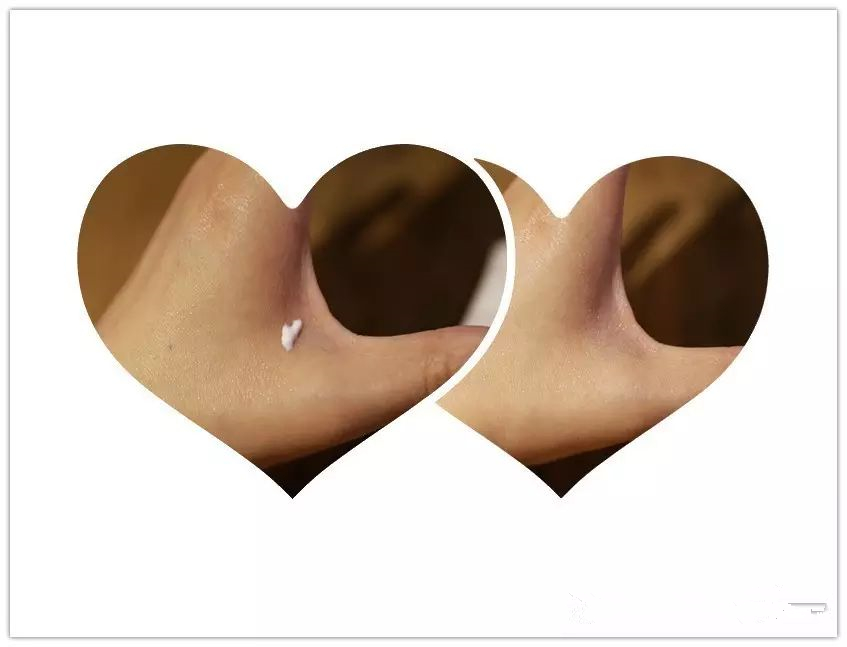 鍛婂埆鑲岃偆闂鎶よ偆,鍛婂埆寰掓墜鎶よ偆鏃朵唬