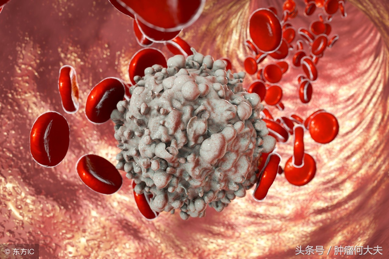 血常规白细胞高还贫血是白血病吗,血常规提示白细胞及血小板减少