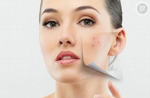 青春时期少女的青春痘怎么办,青春期少女祛痘印