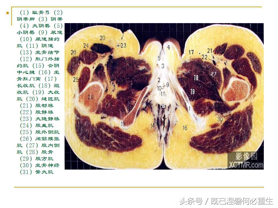 男性盆腔断层解剖图谱,女性盆腔核磁断层解剖