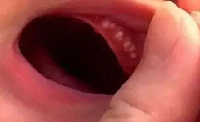 新生儿常见生理现象及护理,新生儿正常生理现象