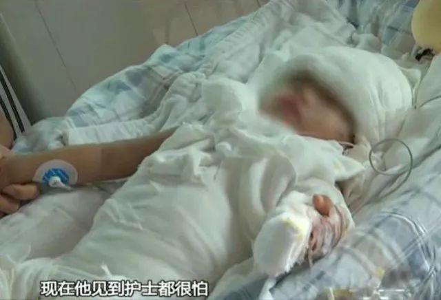 孩子烫伤后发低烧是怎么回事,烫伤三度怎么治疗