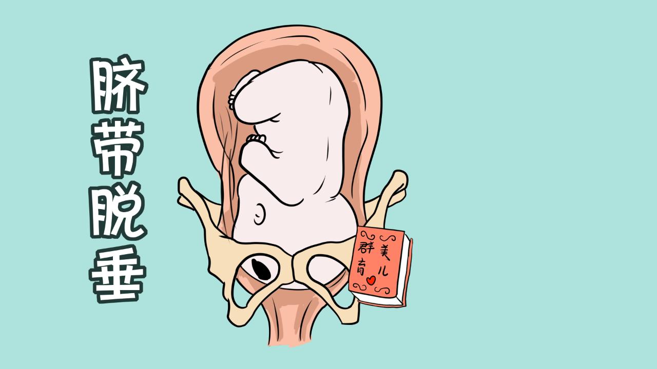 孕妇难产一般是什么情况,孕妇难产的原因和危害
