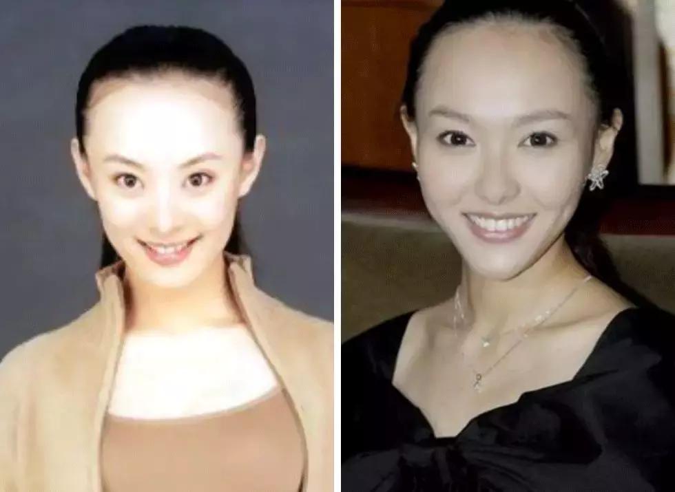 大饼脸拍照不上相怎么改善,大饼脸怎么改善脸型