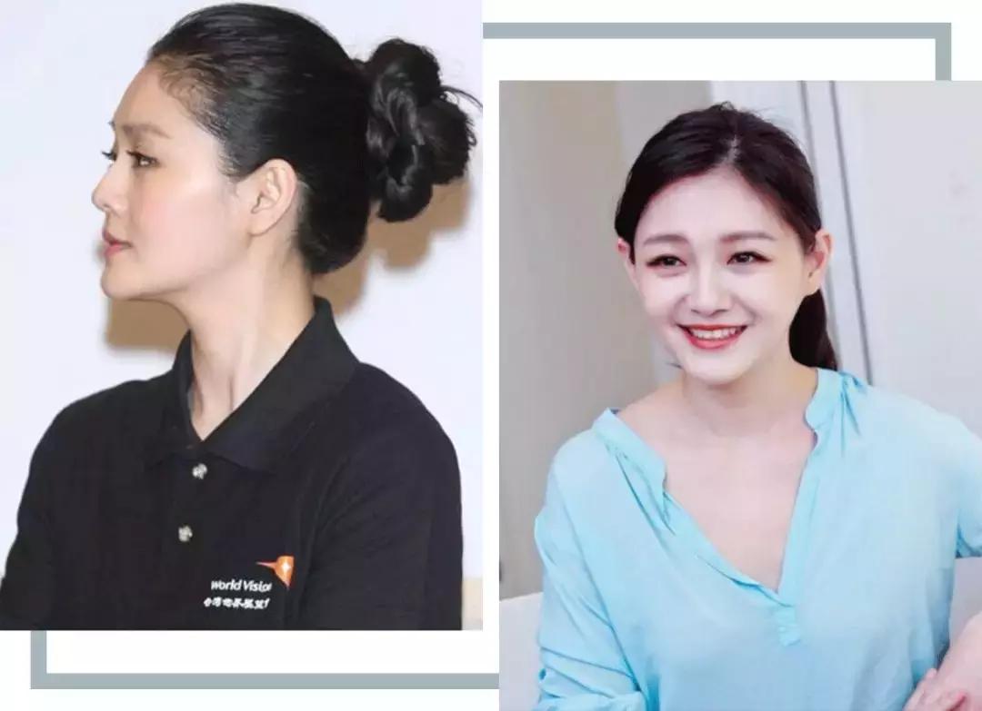 大饼脸拍照不上相怎么改善,大饼脸怎么改善脸型