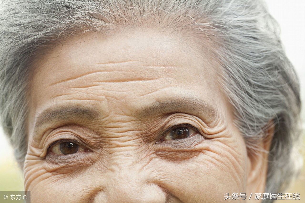 眼角有皱纹怎么消除最快,眼角好多皱纹有什么好方法没有