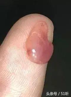 男孩头皮无缘无故很痒是怎么回事,12岁男童头皮发麻会疼是怎么回事