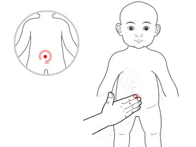 小儿积食腹痛家长应对,小儿积食教宝妈如何消除