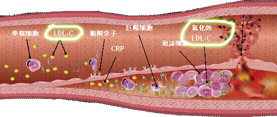 他汀类药物会影响寿命吗,他汀类药物损伤肝脏吗