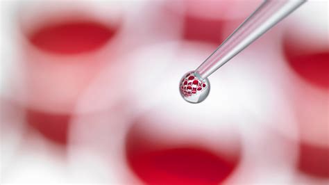 强直性脊柱炎的生物疗法,治疗强直性脊柱炎的最新突破