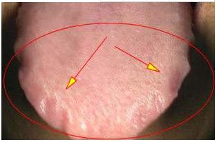 妇科不好脸上会长痘痘怎么办,10岁女孩长痘痘中医该怎么调理