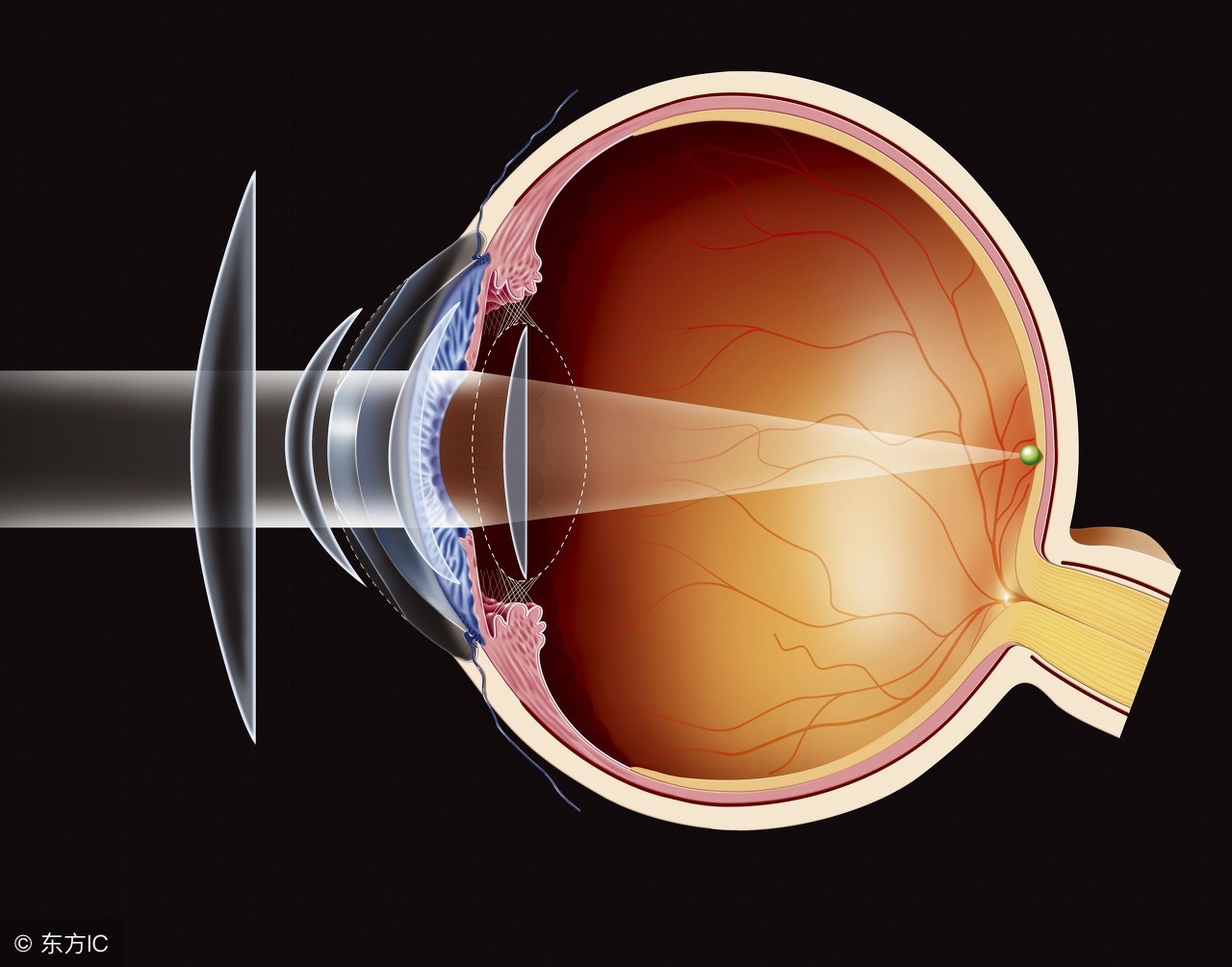 眼球震颤怎么治疗能治愈吗,眼球震颤有治好的吗