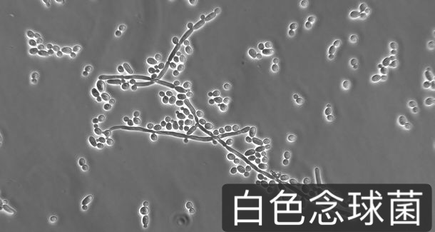 外阴瘙痒尿频白带异味是什么炎症,外阴一直瘙痒尿频尿急