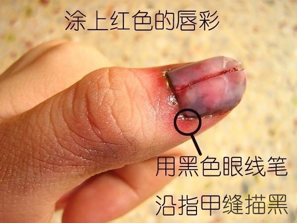 装病请假必备技巧