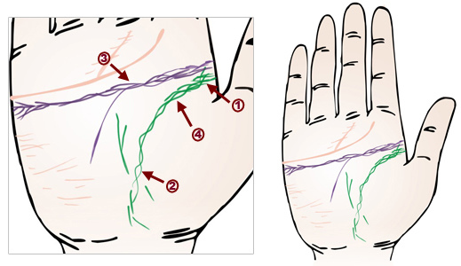 疾病与面相,面相看病人生死之秘诀