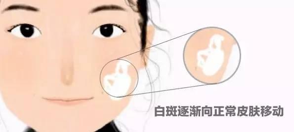 鍗庡鏀跺畼涔嬫垬,鍗庡鎽嗚劚鍗辨満