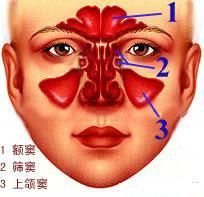 静子养生讲堂,中医如何调理慢性鼻窦炎