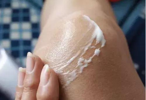 糖友如何应对冬季皮肤瘙痒,糖友皮肤痒用啥药膏擦能解决