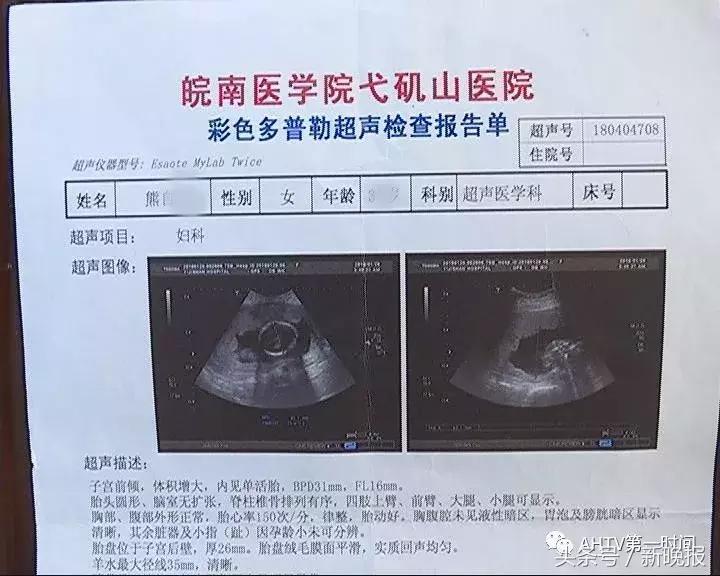 手术前发现怀孕了怎么办,做完手术然后又怀孕了能要吗