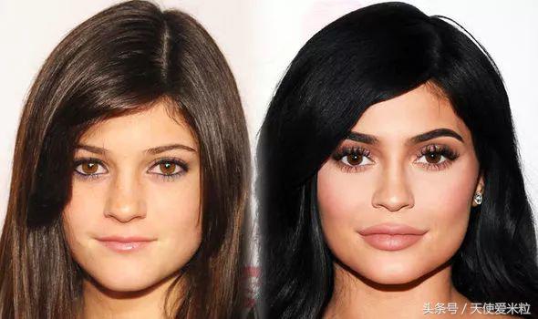 最新的整形塑形手术,7种整形手术可以尝试