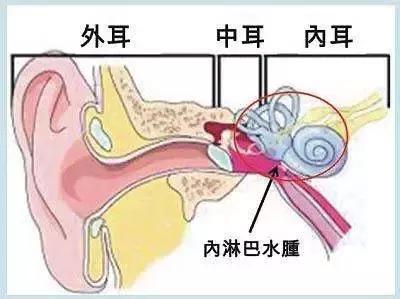 晨起头晕恶心天旋地转是什么原因,总是头晕天旋地转怎么回事