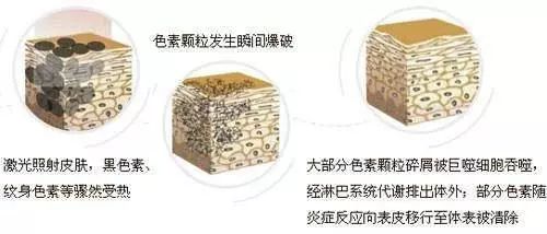 医美血泪教训,医美换脸一夜变美