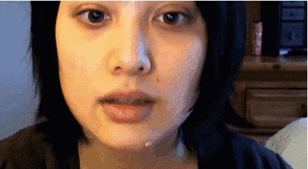 医美血泪教训,医美换脸一夜变美