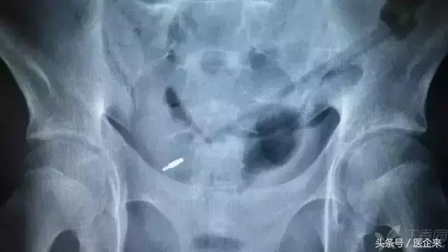 不可思议奇怪的东西,不可思议小物件穿透